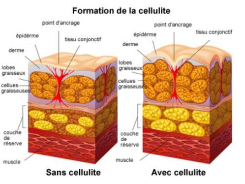 Endermologie anti cellulite dames, Sport en Fitness, Gezondheidsproducten en Wellness, Nieuw, Lichaamsverzorging, Ophalen of Verzenden