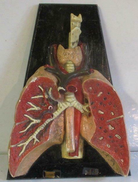 antiek anatomisch model longen jaren 30 !, Verzamelen, Overige Verzamelen, Gebruikt