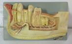 antiek anatomisch model van tanden Ivac Brussel, Antiek en Kunst, Curiosa en Brocante, Verzenden