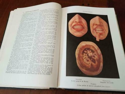 Rehm encyclopédie, Antiquités & Art, Antiquités | Livres & Manuscrits, Envoi
