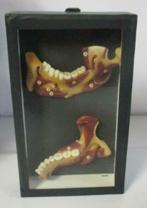 vintage wassen anatomisch model van een gebit 1A, Natuur en Biologie, Verzenden