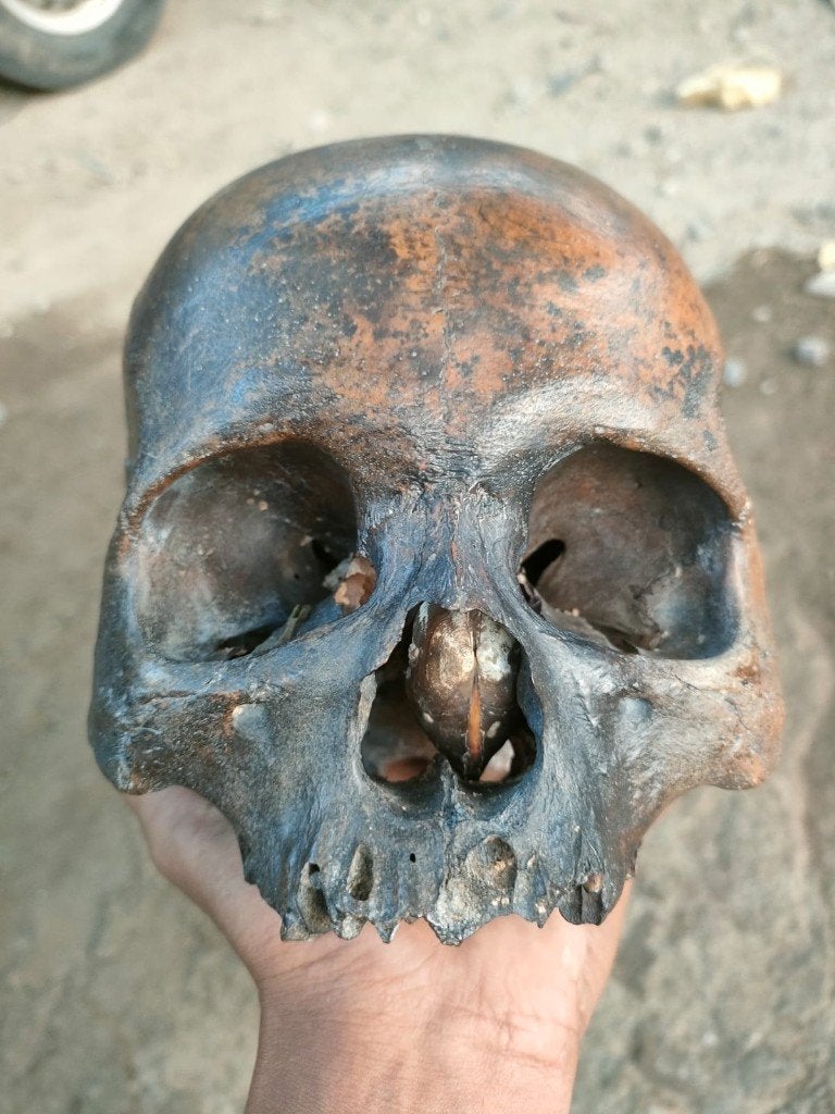 Homo sapiens, Collections, Collections Autre, Enlèvement ou Envoi, Utilisé