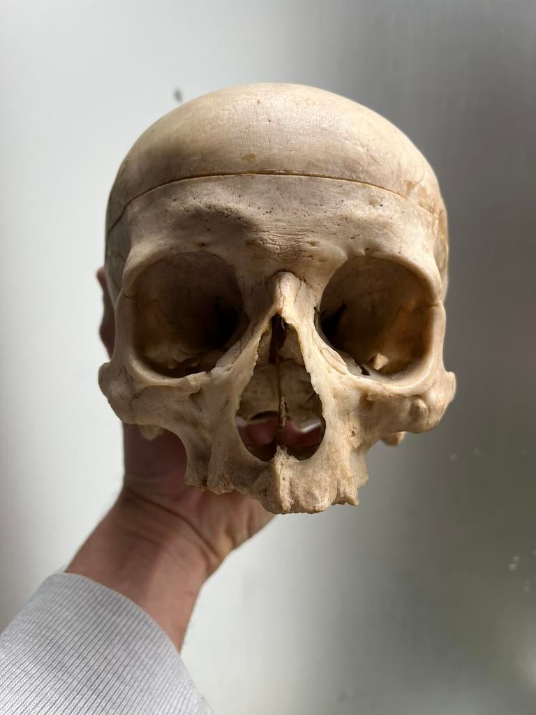 Svhedel mens skull, Ophalen of Verzenden, Gebruikt