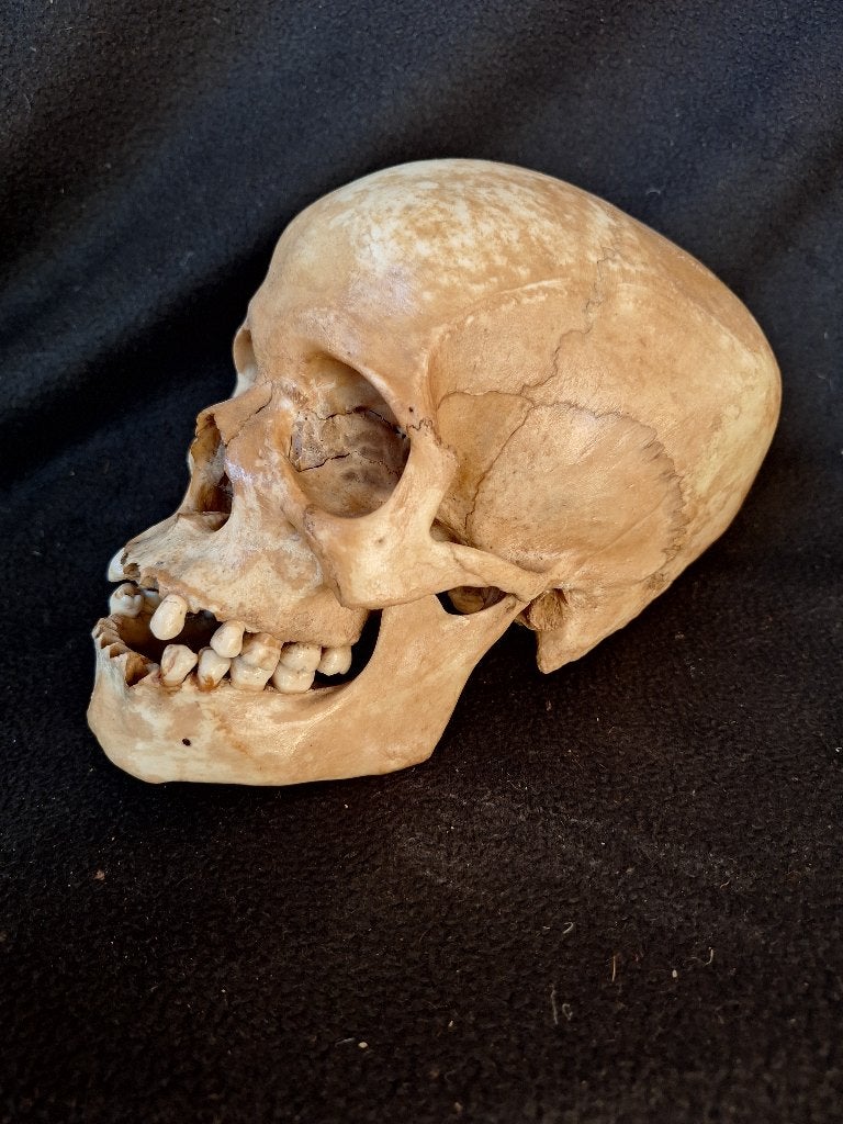 Afrikaans vrouwelijke schedel mens (echt), Verzamelen, Dierenverzamelingen, Ophalen of Verzenden, Zo goed als nieuw, Overige soorten