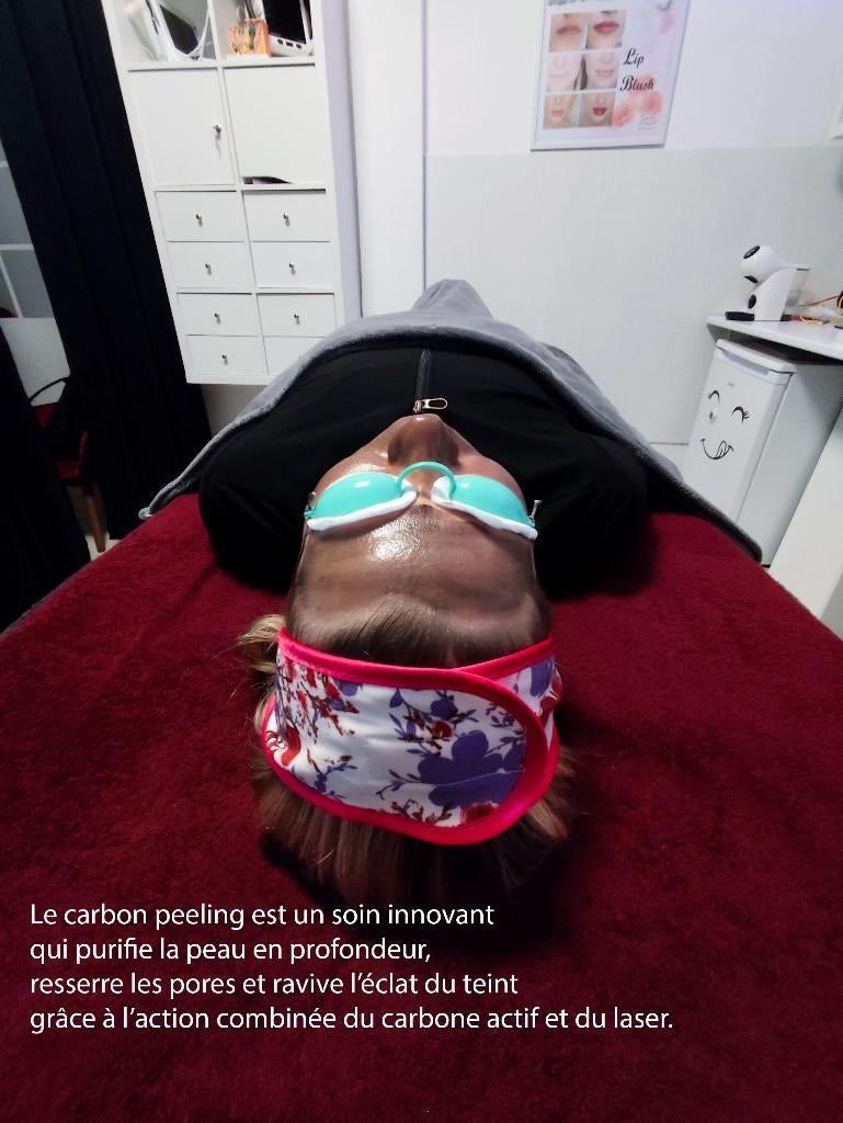 Soin visage Carbone Peeling, Enlèvement, Neuf, Tout le visage, Nettoyage