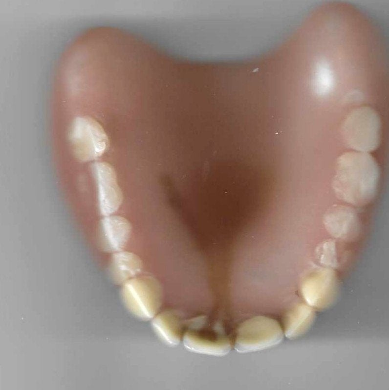 Kunstgebit, Bijoux, Sacs & Beauté, Beauté | Soins de la bouche, Enlèvement ou Envoi, Utilisé, Autres types