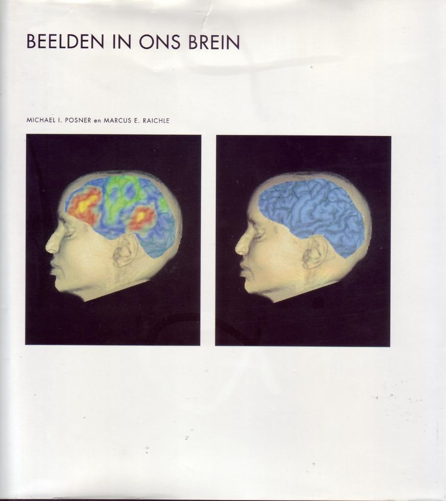 NATUUR EN TECHNIEK BEELDEN IN ONS BREIN PET-scan neurologie, Enlèvement ou Envoi, Comme neuf, Sciences naturelles