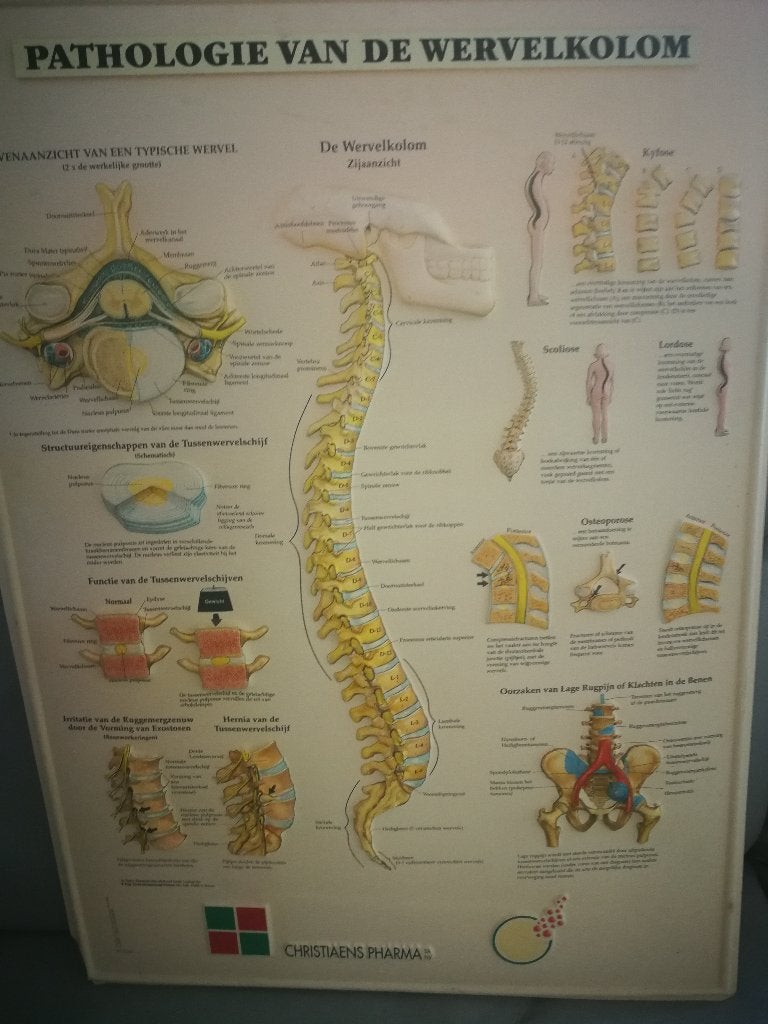 Kaart Pathologie van de wervelkolom in 3D, Antiquités & Art, Antiquités | Cartes scolaires, Enlèvement, Autres thèmes