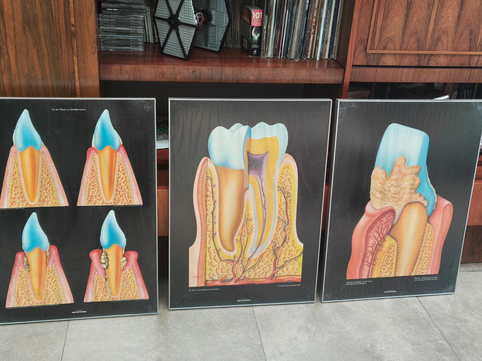 Drie anatomische posters uit dokterkabinet tandarts 80's, Ophalen, Met lijst, A1 t/m A3, Overige onderwerpen