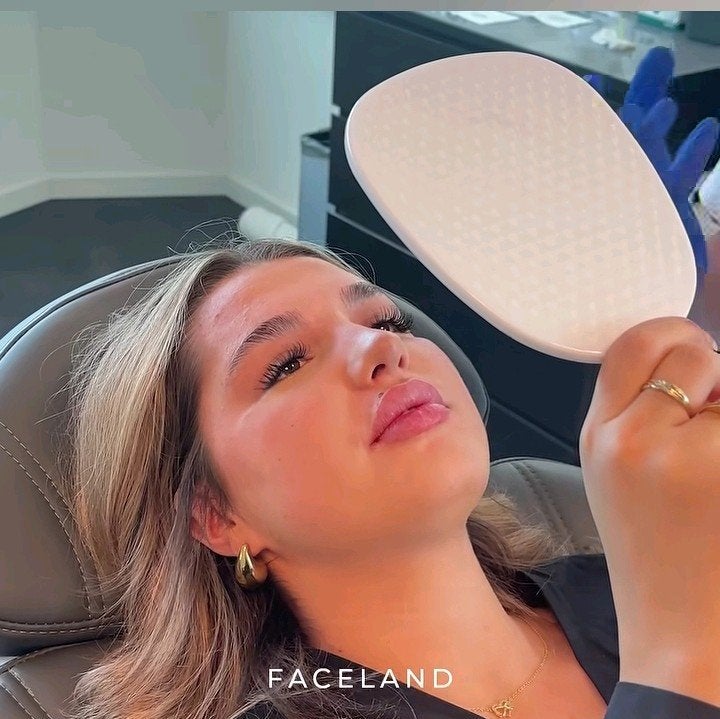 lipfillers faceland, Tickets en Kaartjes