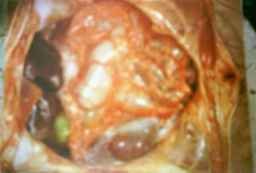 HUMEN war BODY teror AFTER agressie., Verzenden