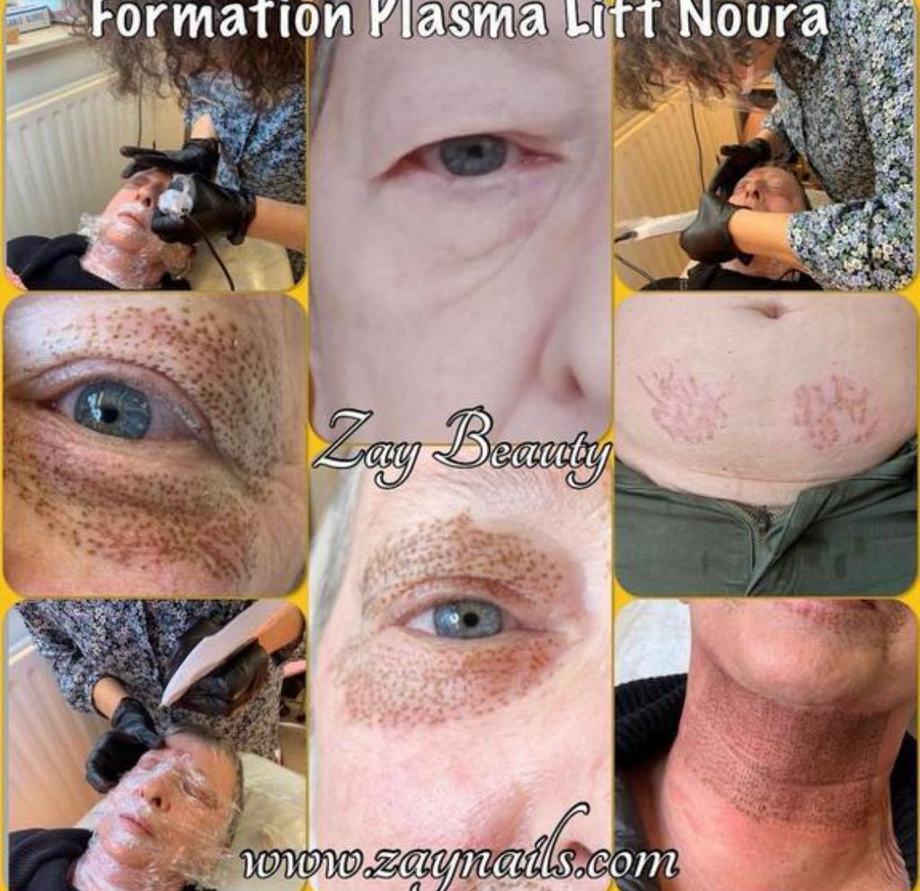 formation plasma Lift, Vacatures, Vacatures | Modellen