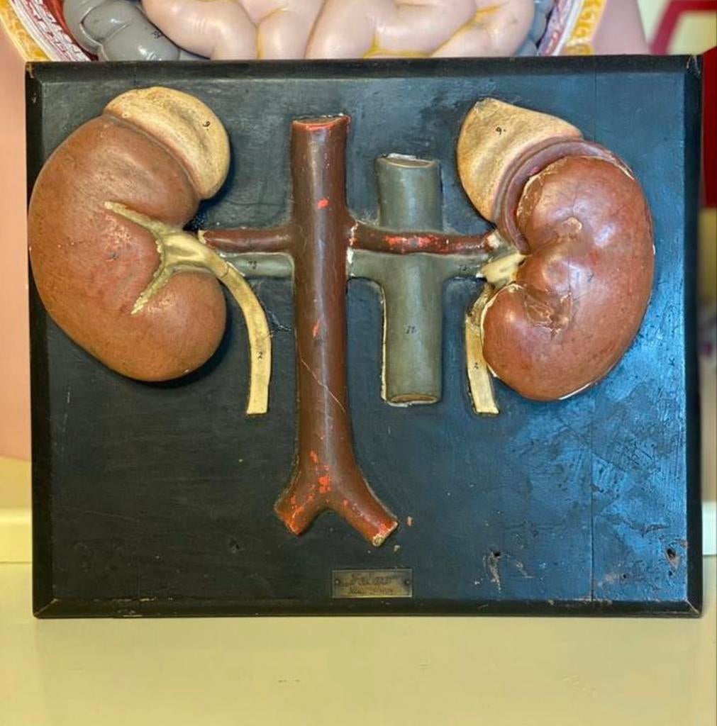 antiek plaaster niermodel anatomie, Antiek en Kunst, Ophalen of Verzenden