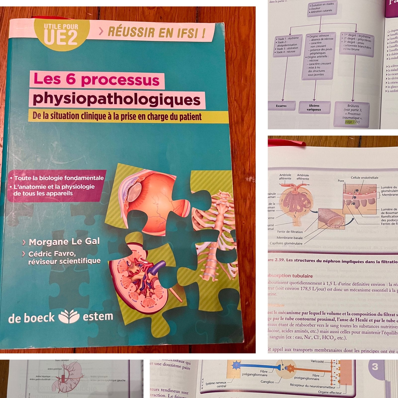 Les 6 processus physiopathologiques:De la situation clinique, Livres, Enlèvement ou Envoi, Utilisé, Autres sciences