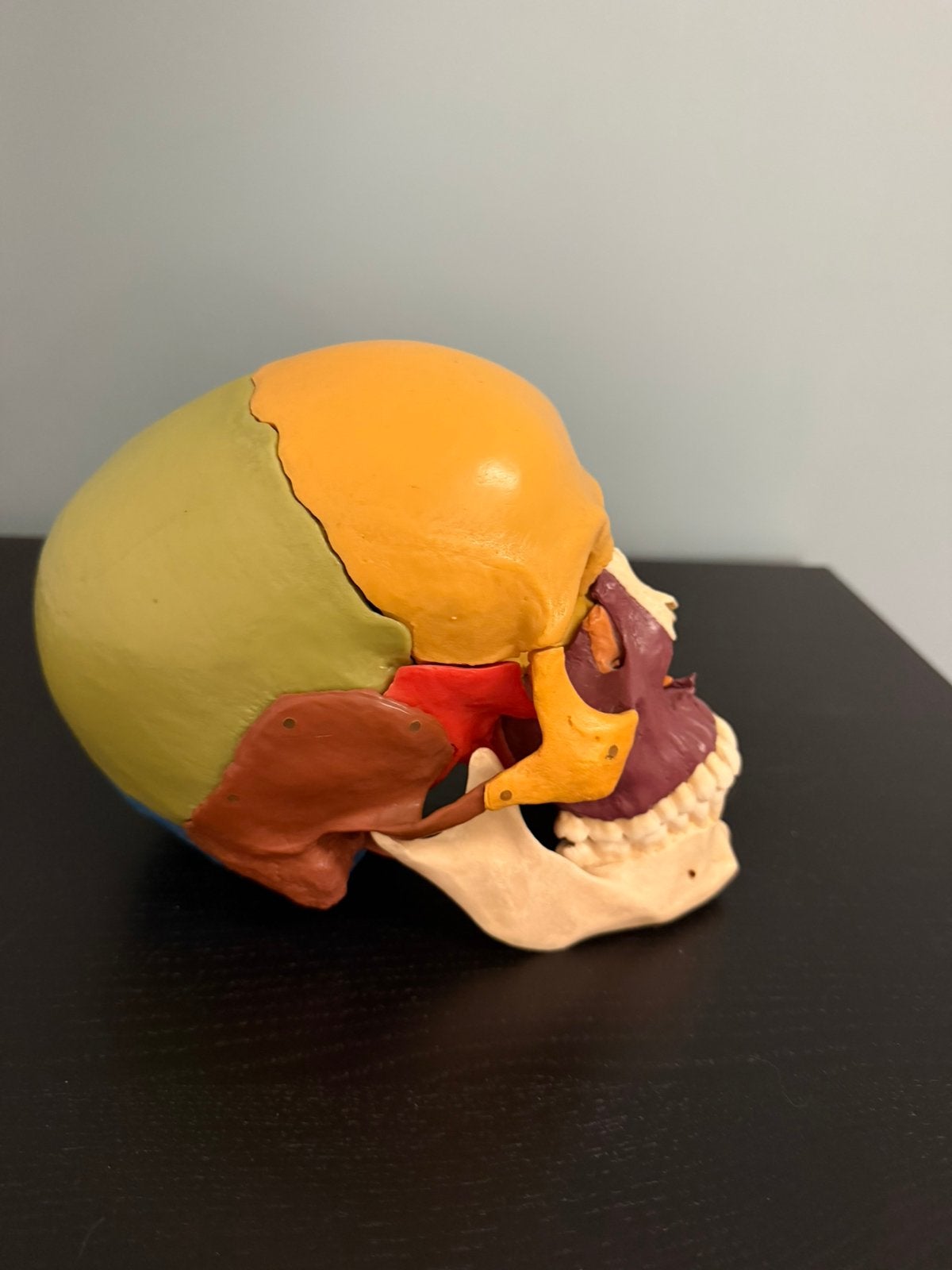 SOMSO anatomische schedel 14 stuks — Uitstekende conditie, Verzamelen, Ophalen of Verzenden, Zo goed als nieuw, Merk