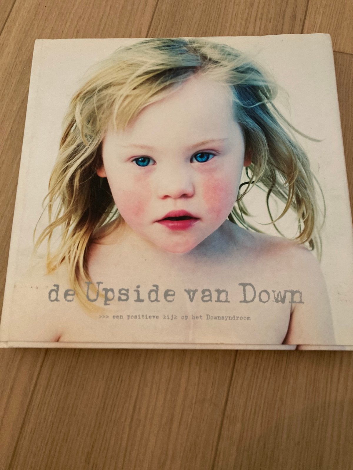 Down syndroom, Ophalen, Zo goed als nieuw