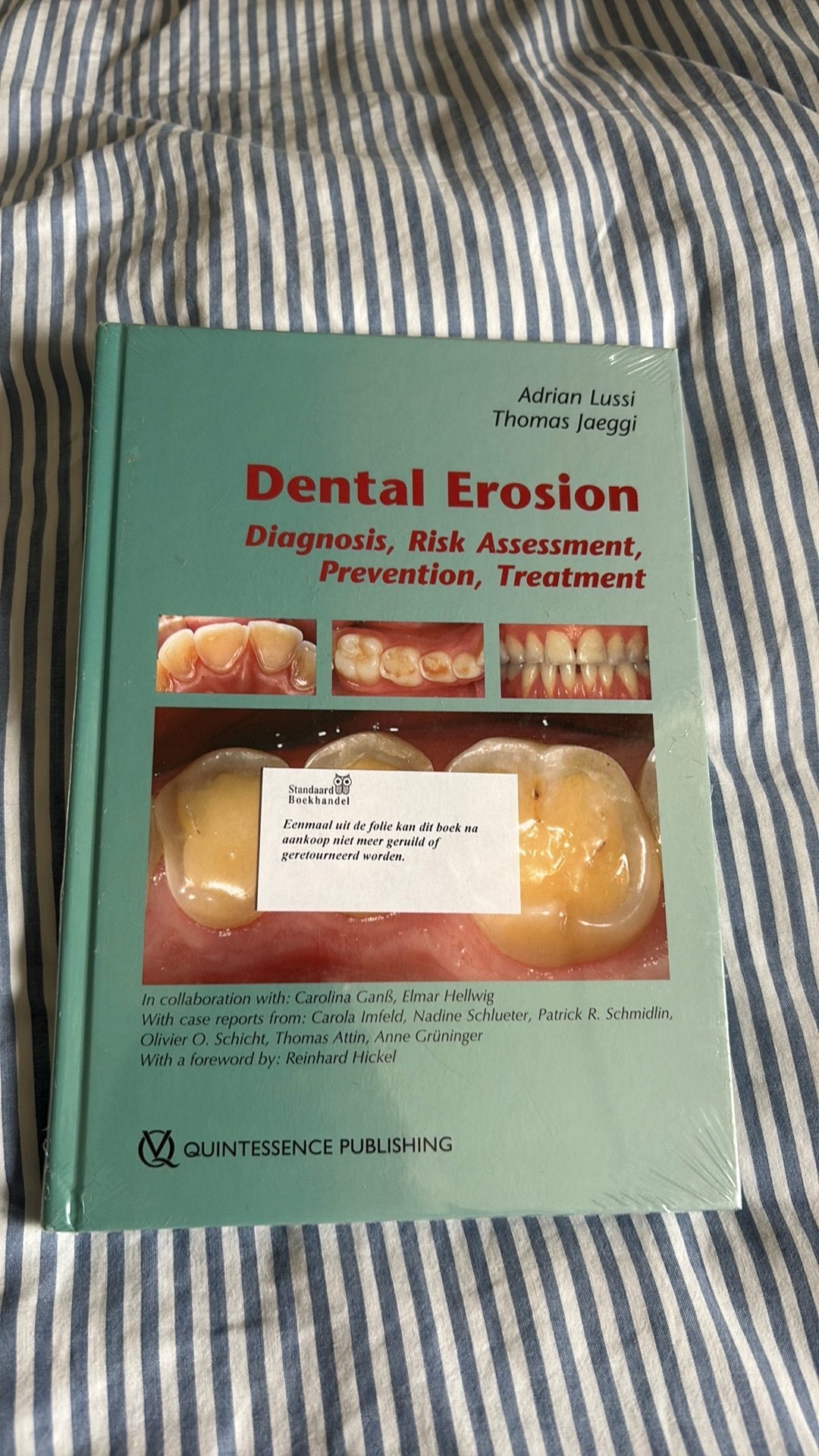 Dental Erosion, Diversen, Ophalen, Zo goed als nieuw