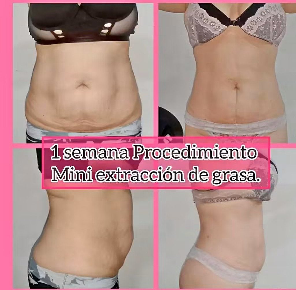 Professionele Massage § Gezichtsreiniging, Diensten en Vakmensen, Massage