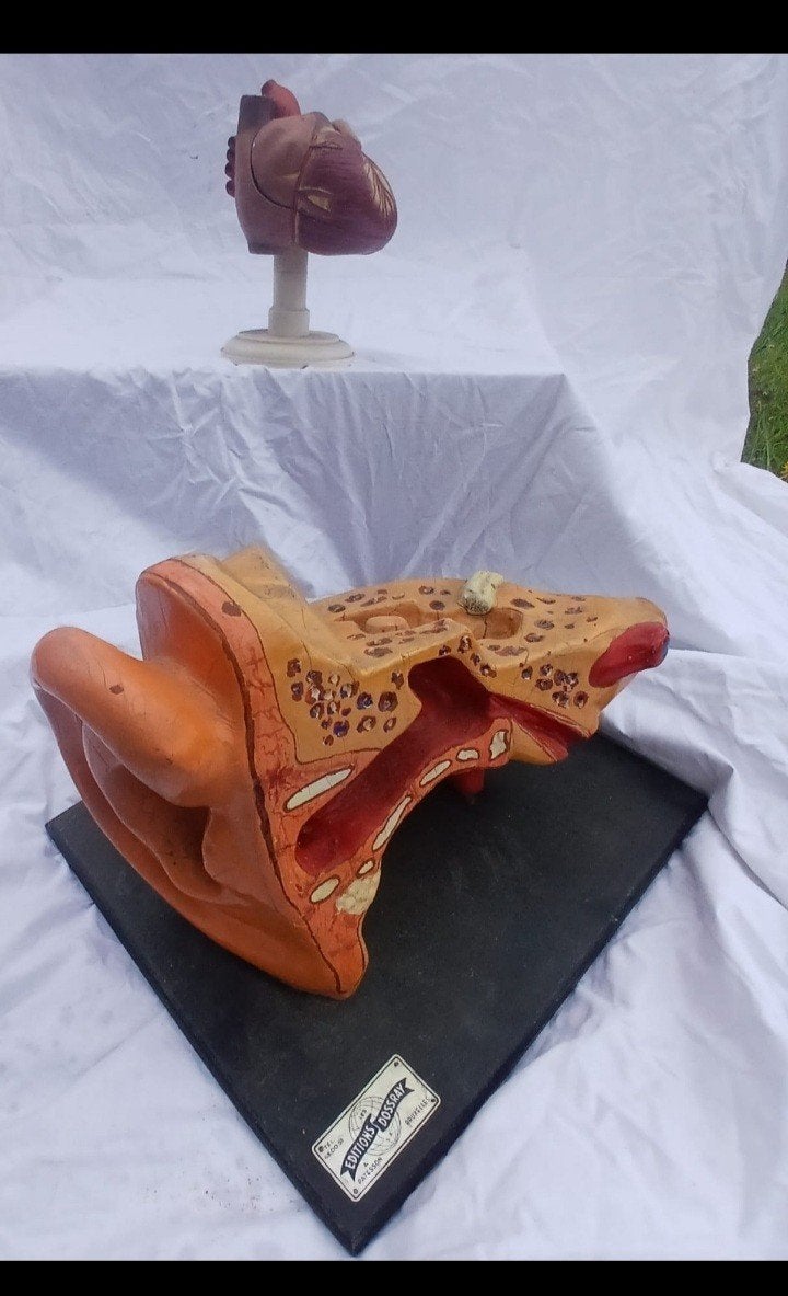 Objet didactique médical curiosite science, Enlèvement