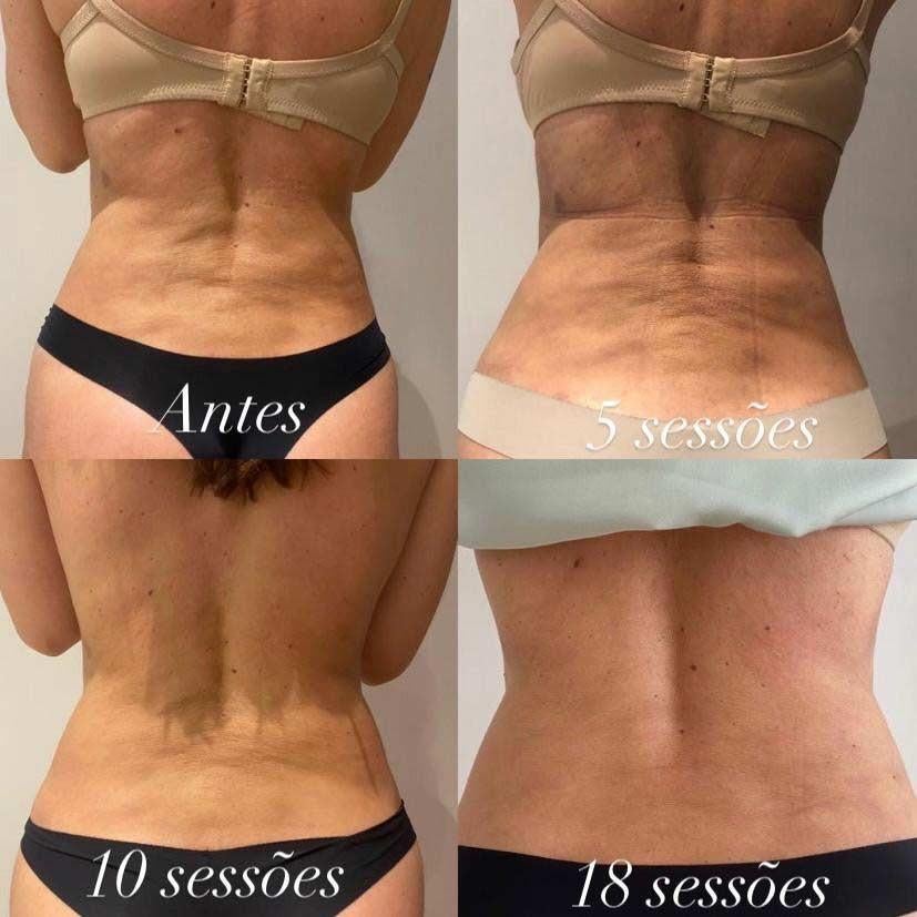 Massage, Contacten en Berichten