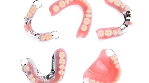 Réalisation de prothèse dentaire, Enlèvement, Neuf