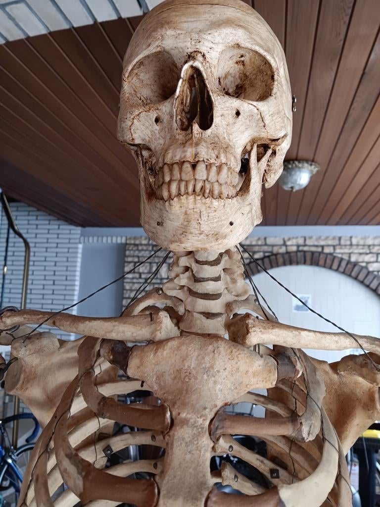 Anatomie skelet, Ophalen