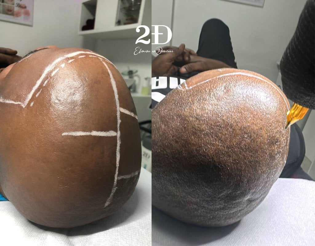 Dermopigmentation capillaire à Bruxelles, Bijoux, Sacs & Beauté, Enlèvement, Neuf, Soin des cheveux ou Soin réparateur des cheveux
