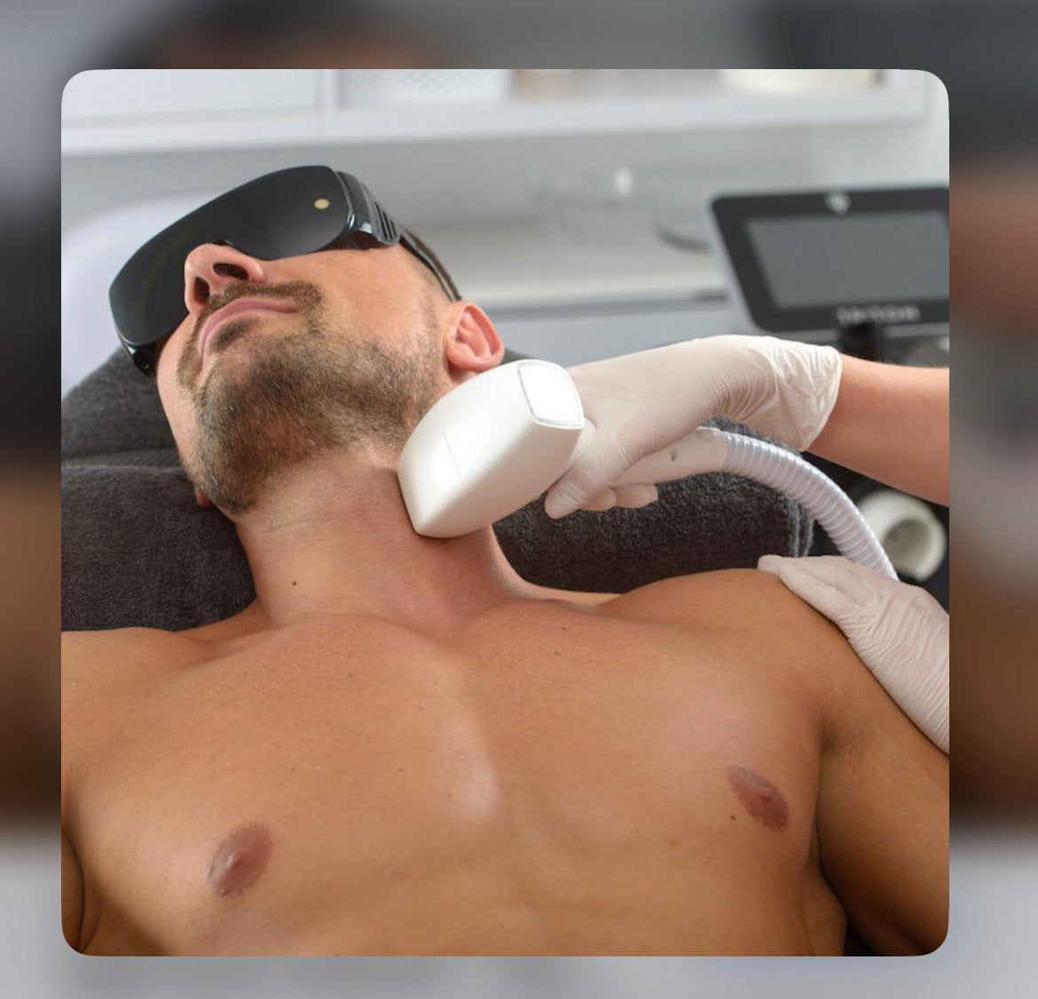 Besoin d’un modèle homme pour séance épilation laser Bxl, Sport en Fitness, Ophalen, Zo goed als nieuw