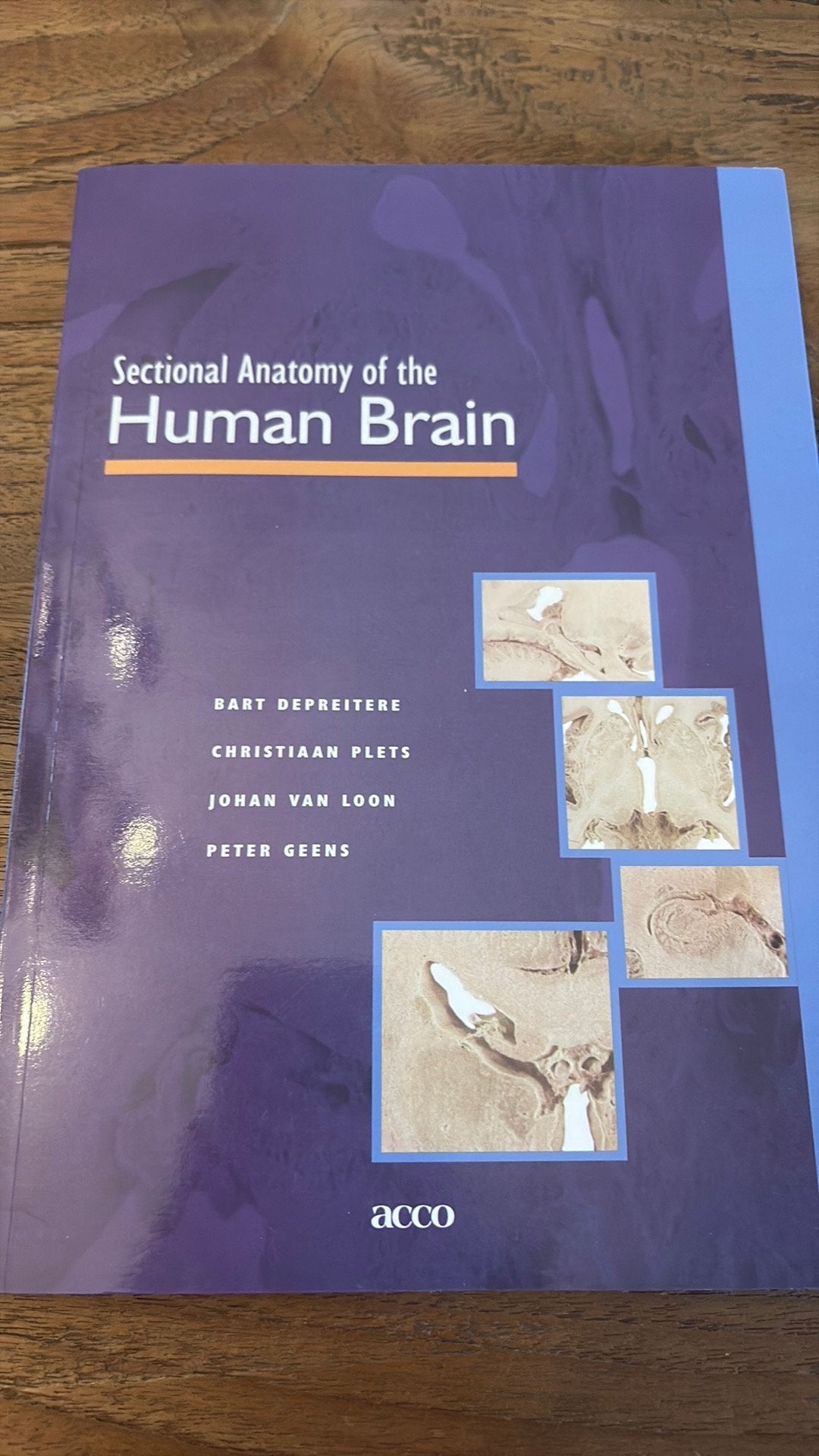 Sectional anatomy of the human brain, Boeken, Ophalen