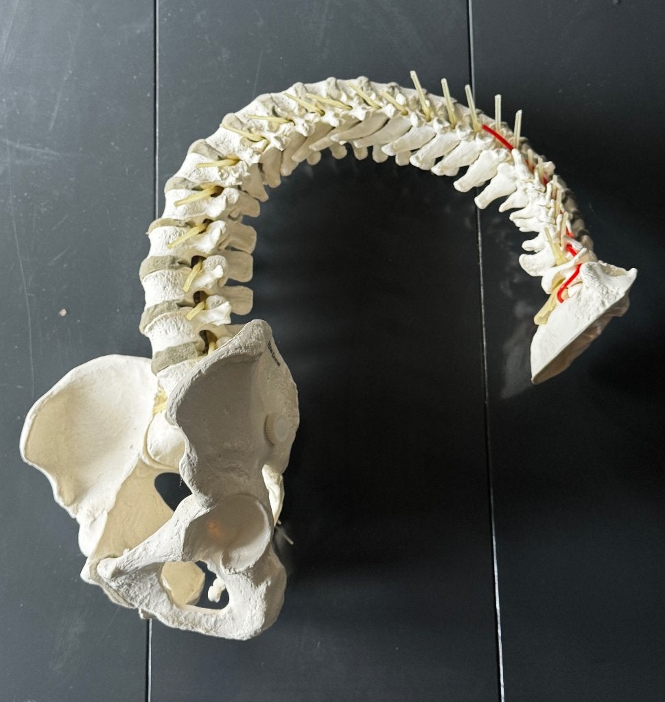 Èchte flexibele wervelkolom van Erler-Zimmer, Ophalen