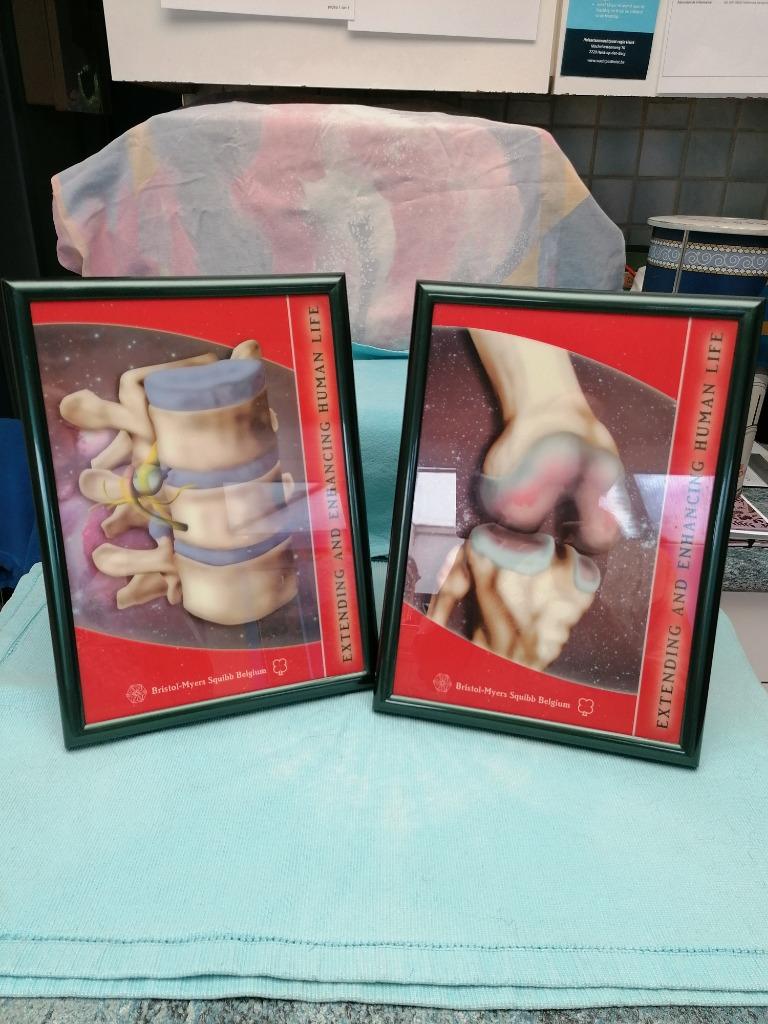 2 medische 3D illustraties GRATIS, Antiek en Kunst, Curiosa en Brocante, Ophalen