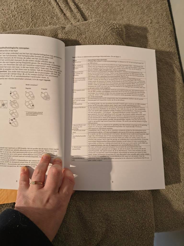 Ecg handboek, Enlèvement