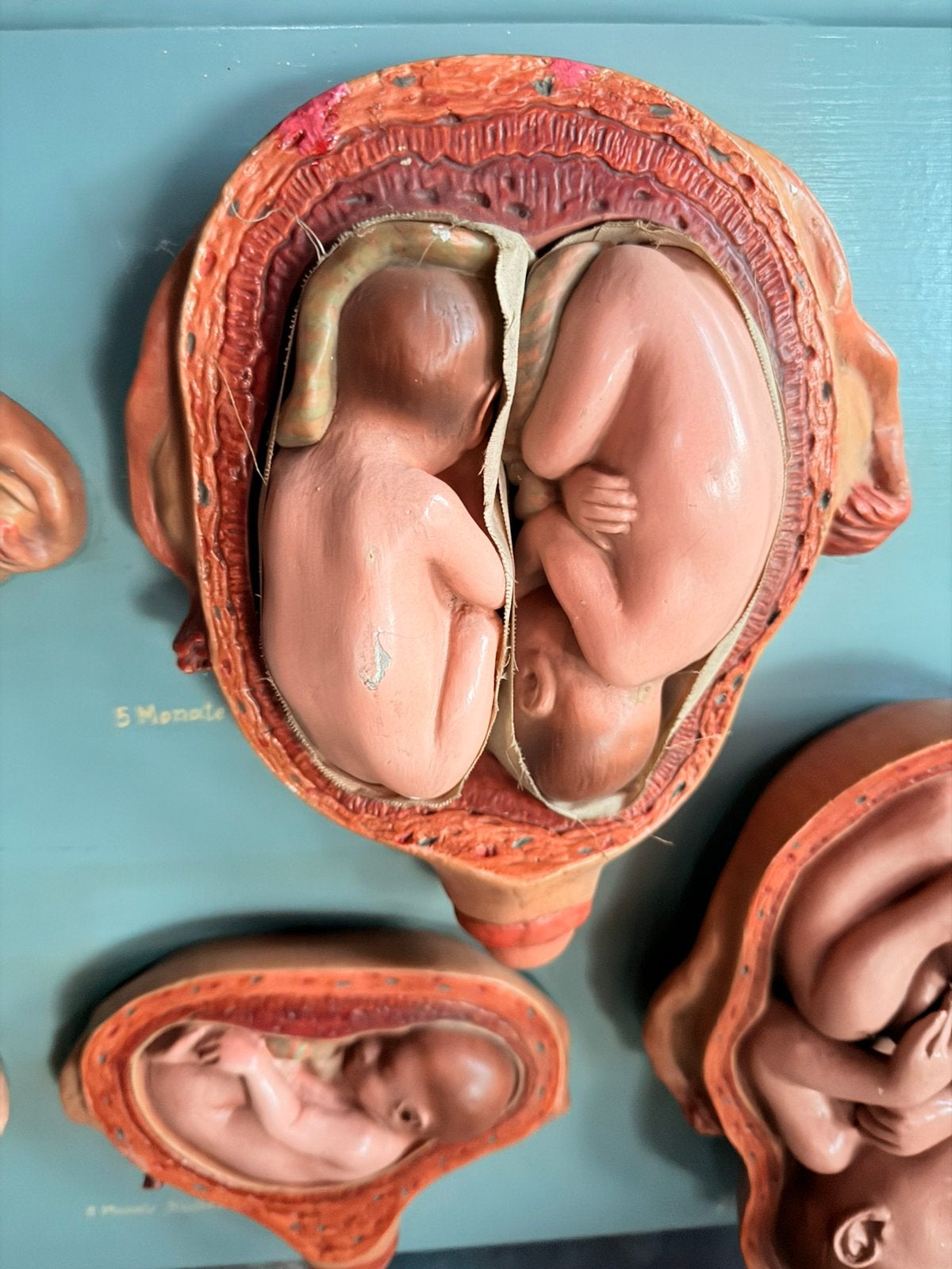 Anatomie model kader embryo kraam vintage retro, Antiek en Kunst, Kunst | Schilderijen | Modern, Handgeschilderd, Ophalen of Verzenden