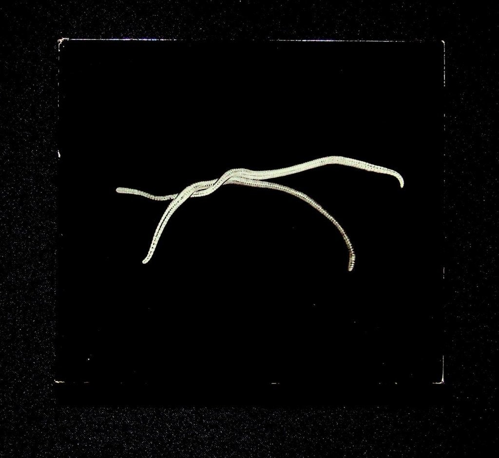 Scheer: Shéa, CD & DVD, Digipak, Utilisé, Single, Indie rock