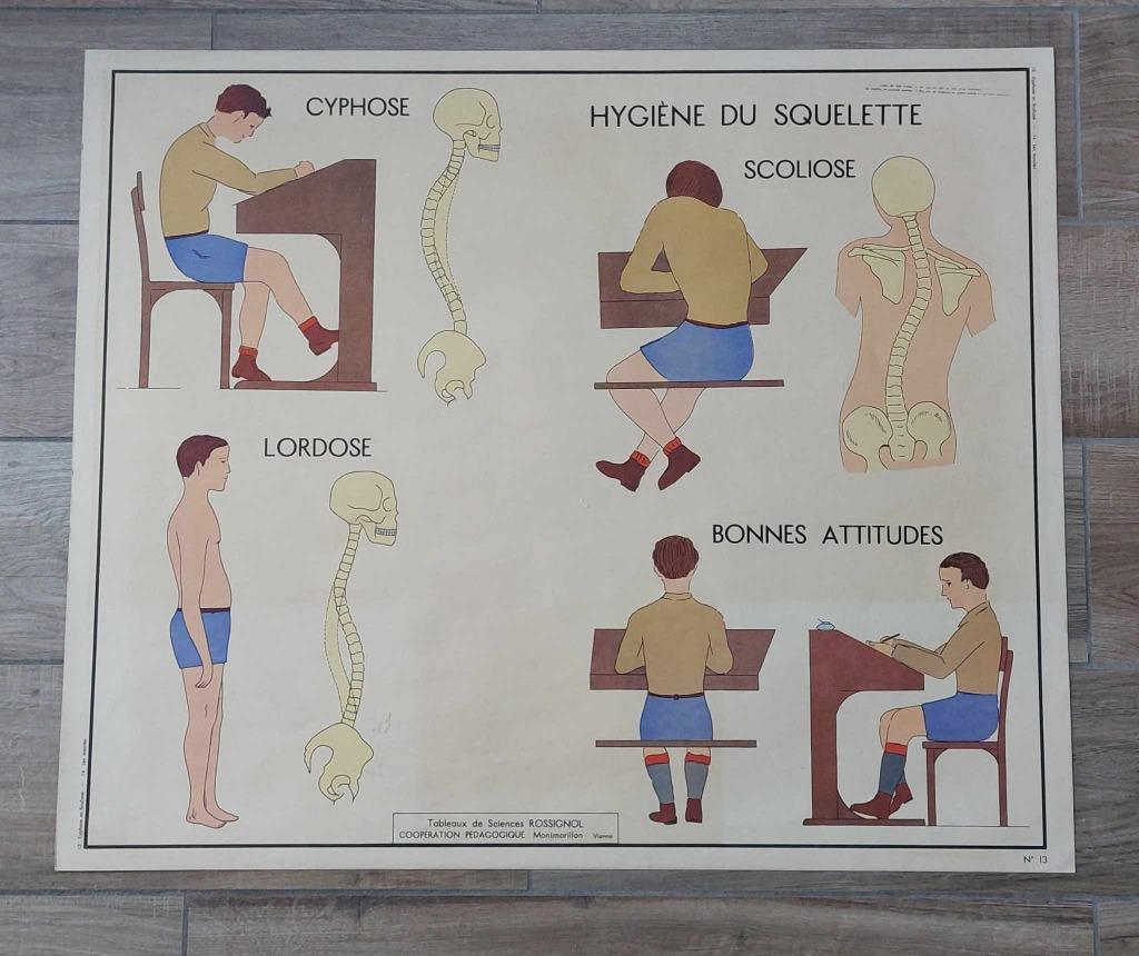 Ancienne planche didactique Rossignol corps humain 13 et 14, Enlèvement ou Envoi