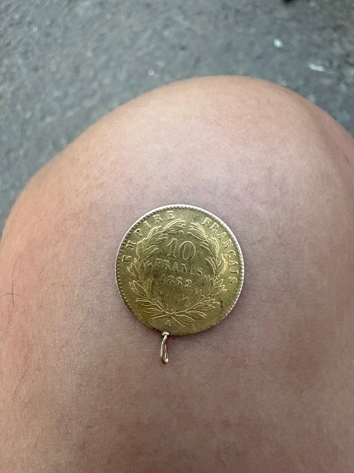10 franc Napoléon, Enlèvement