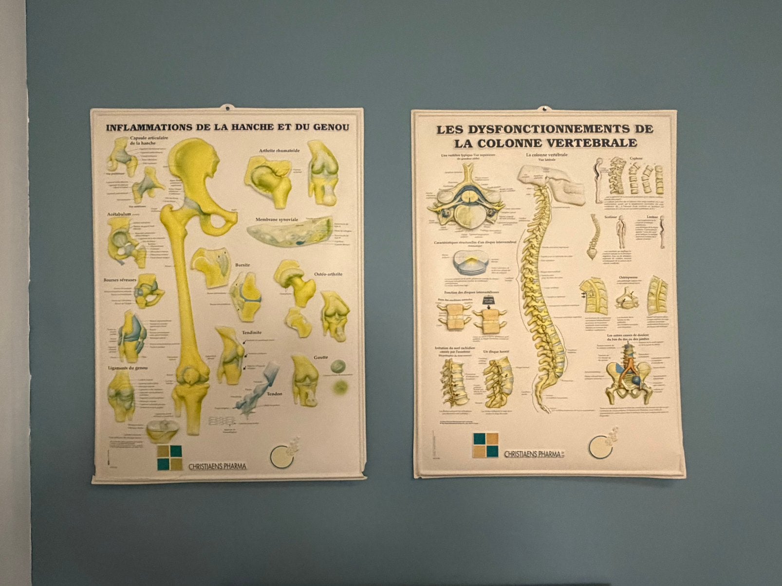 Set van 3 anatomische posters - Medisch kantoor/osteo/fysio, Ophalen of Verzenden