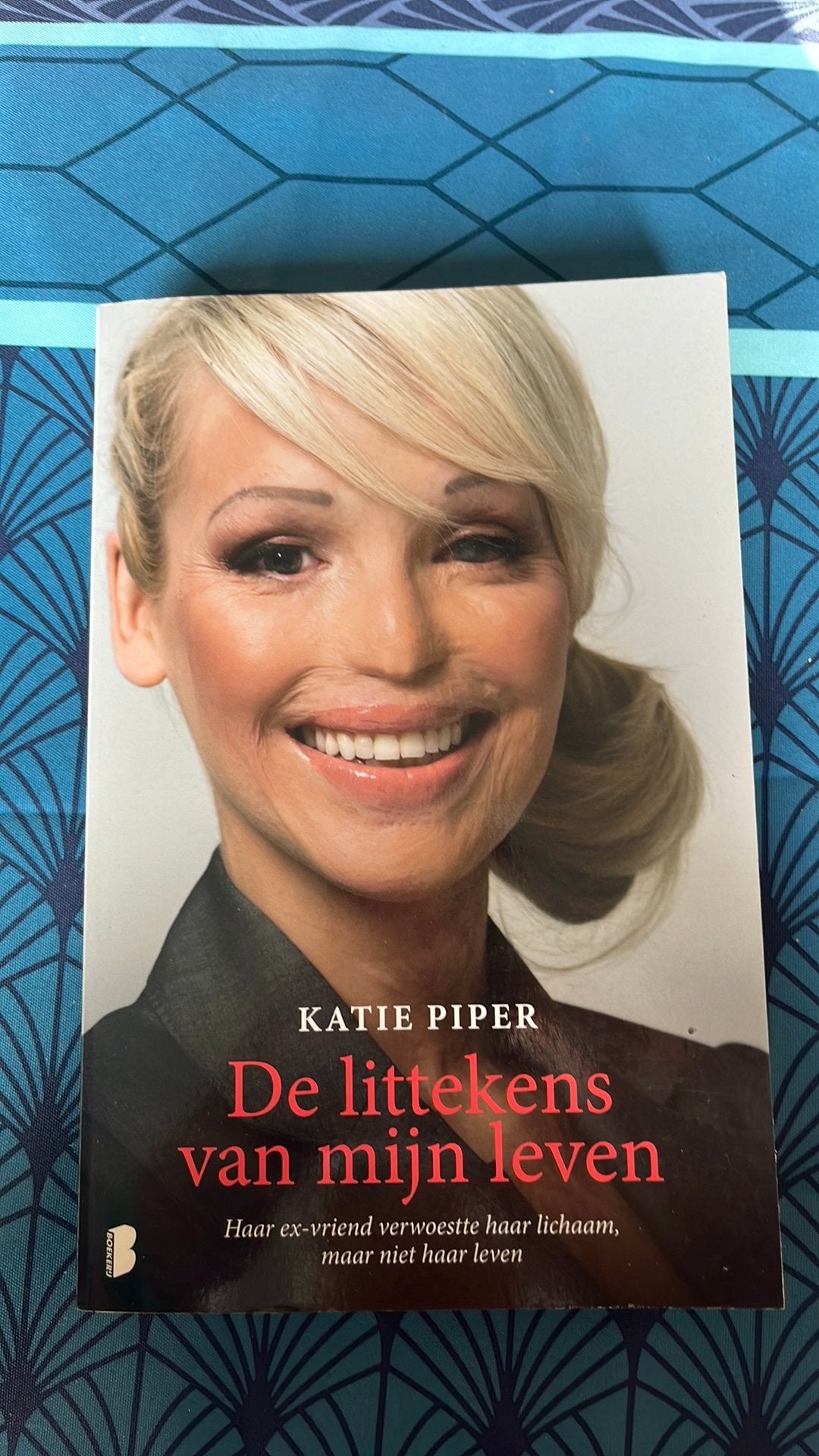 Katie Piper - De littekens van mijn leven, Ophalen, Katie Piper