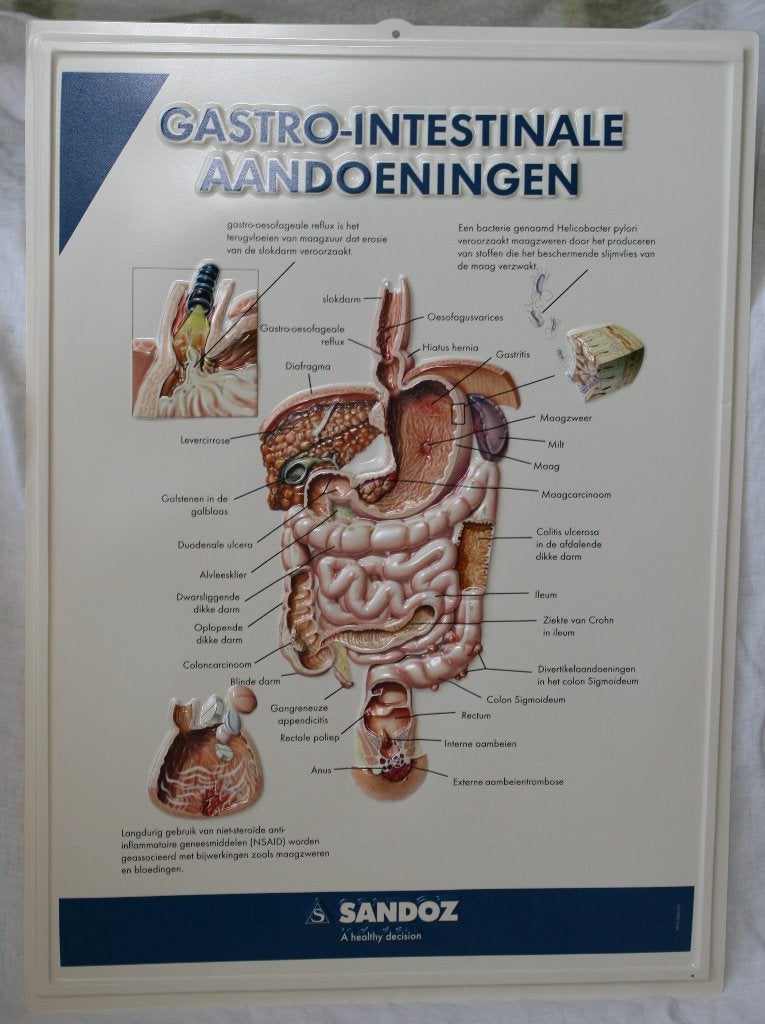 Anatomie poster - Gastro-intestinale aandoeningen, Enlèvement ou Envoi