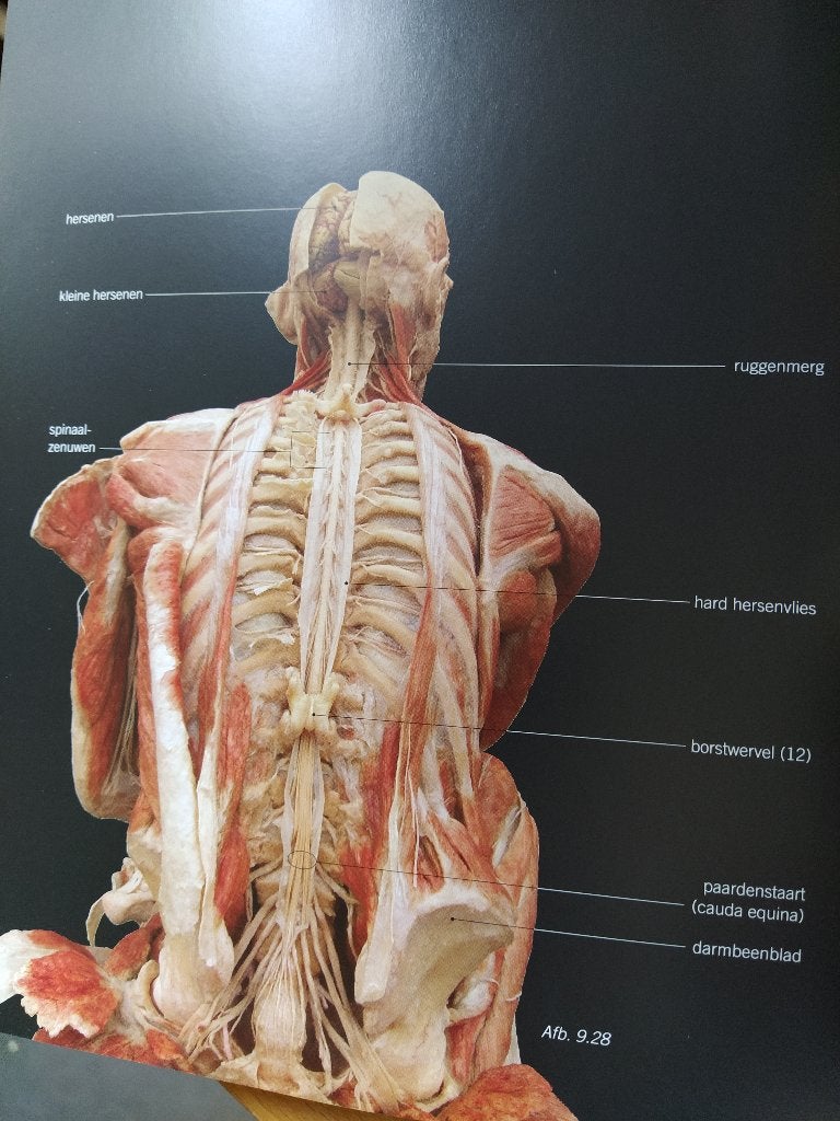 boek: Body worlds - Gunther von Hagens', Ophalen of Verzenden, Natuurwetenschap