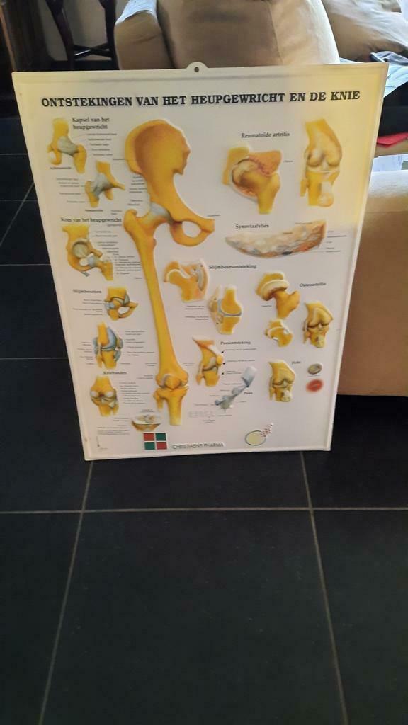 Panneau médical en plastique, articulation de la hanche et d, Enlèvement ou Envoi