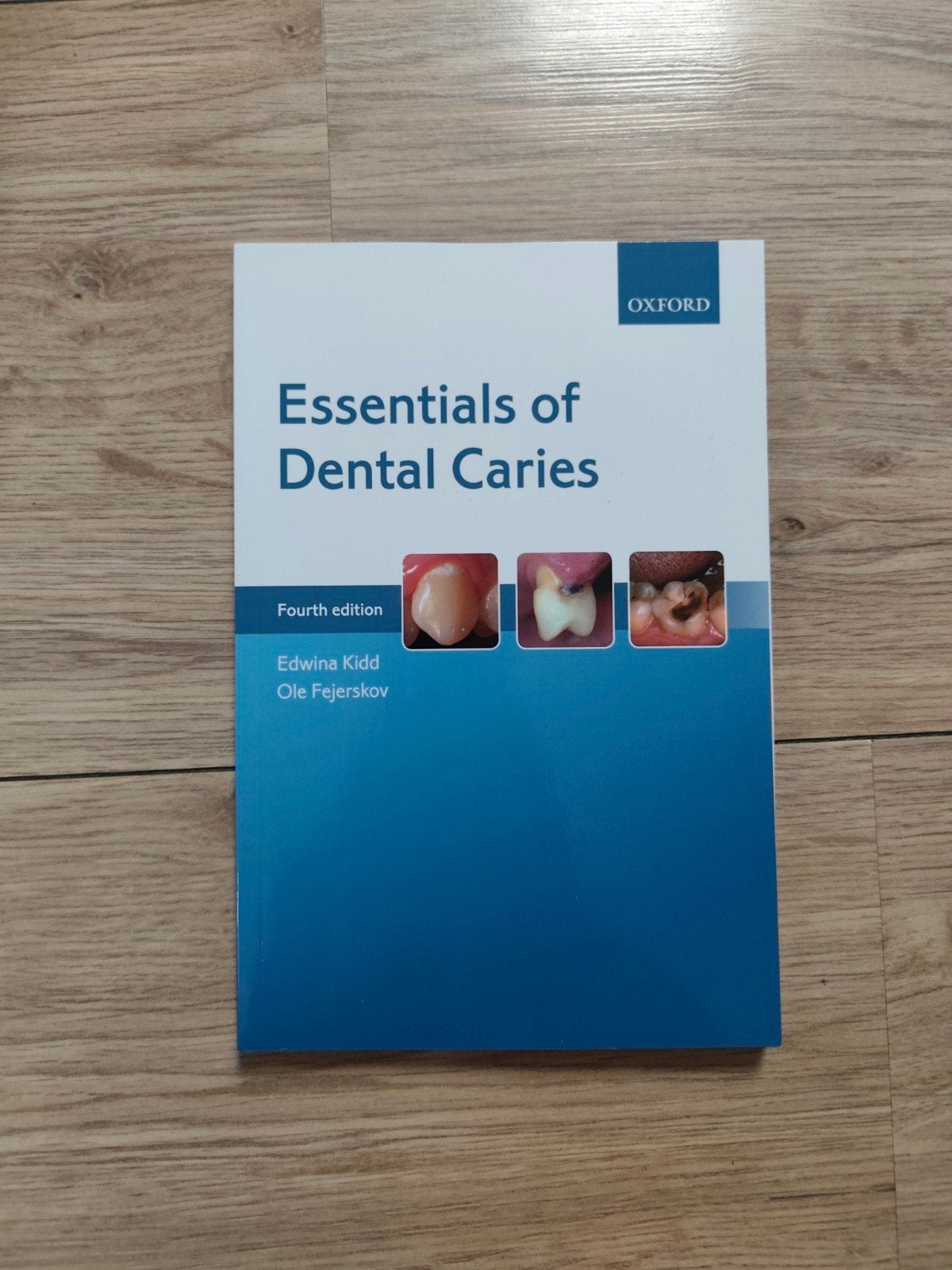 Studieboek: Essentials of Dental Caries, Ophalen of Verzenden, Edwina Kidd, Ole Fejerskov