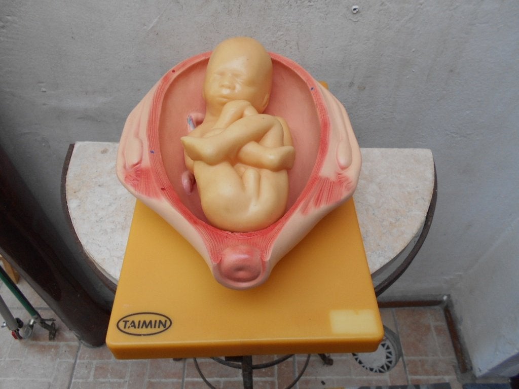 anatomisch-model-foetus in baarmoeder-didactisch 1970, Enlèvement ou Envoi