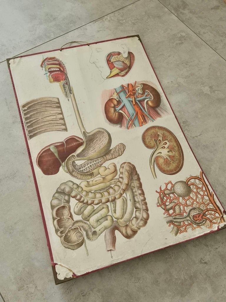 Schoolplaat Anatomie, Ophalen