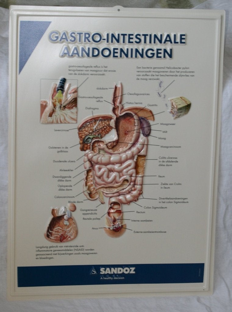 Anatomie poster - Gastro-intestinale aandoeningen, Ophalen of Verzenden, Zo goed als nieuw