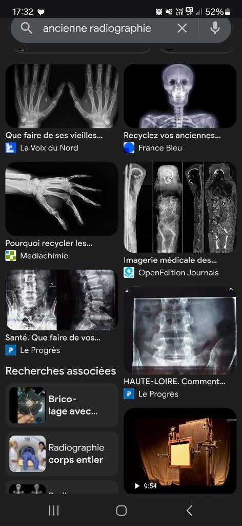 Recherche vielles radiographies, Enlèvement, Utilisé