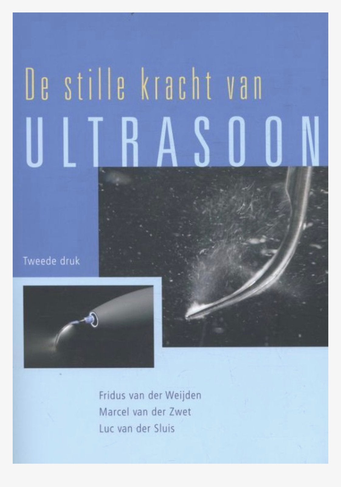 E-book De stille kracht van ultrasoon Mondzorg, Ophalen, Nieuw, Overige vakken