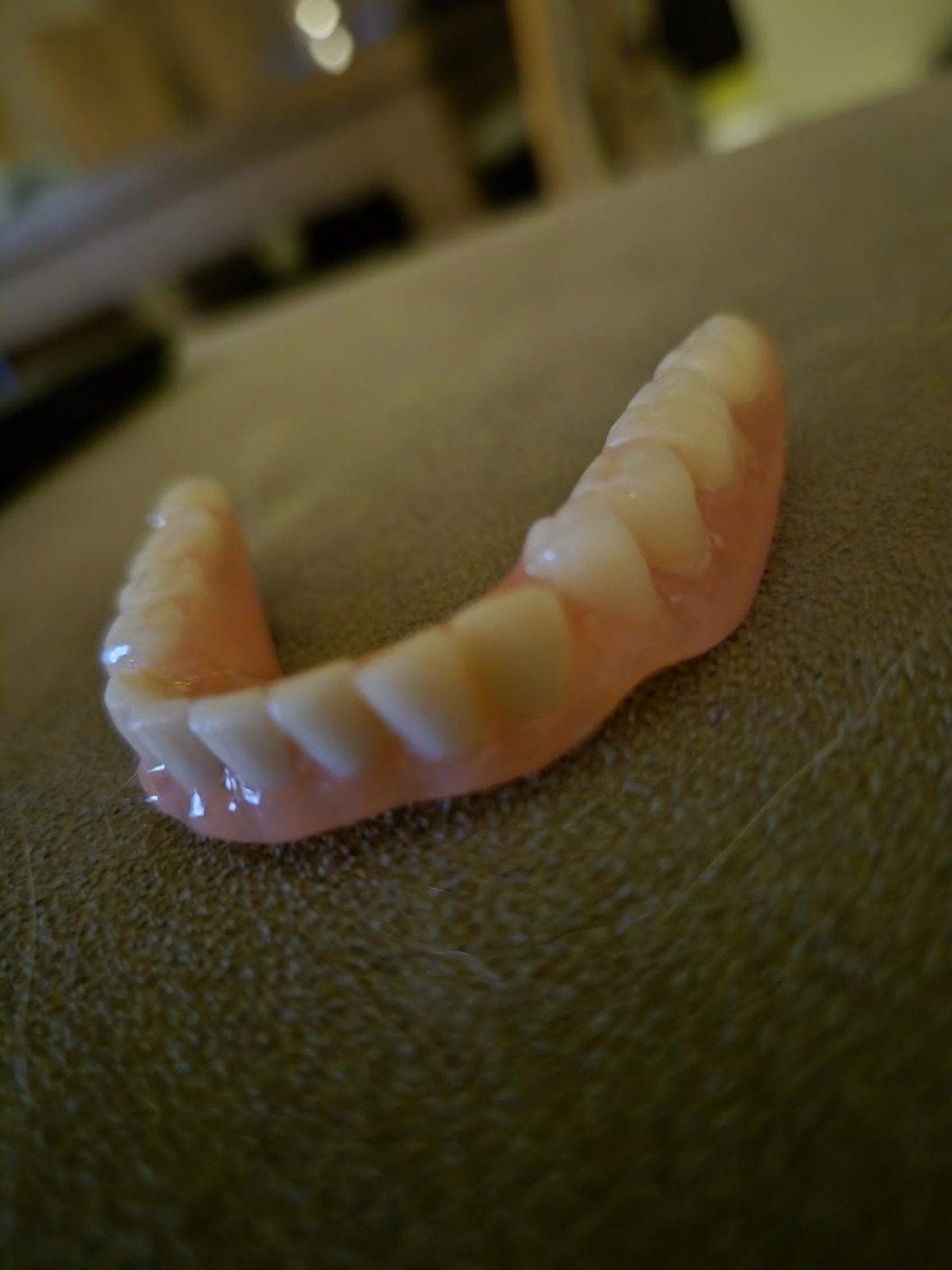 Tandprothese deurzaam herstelen, Ophalen