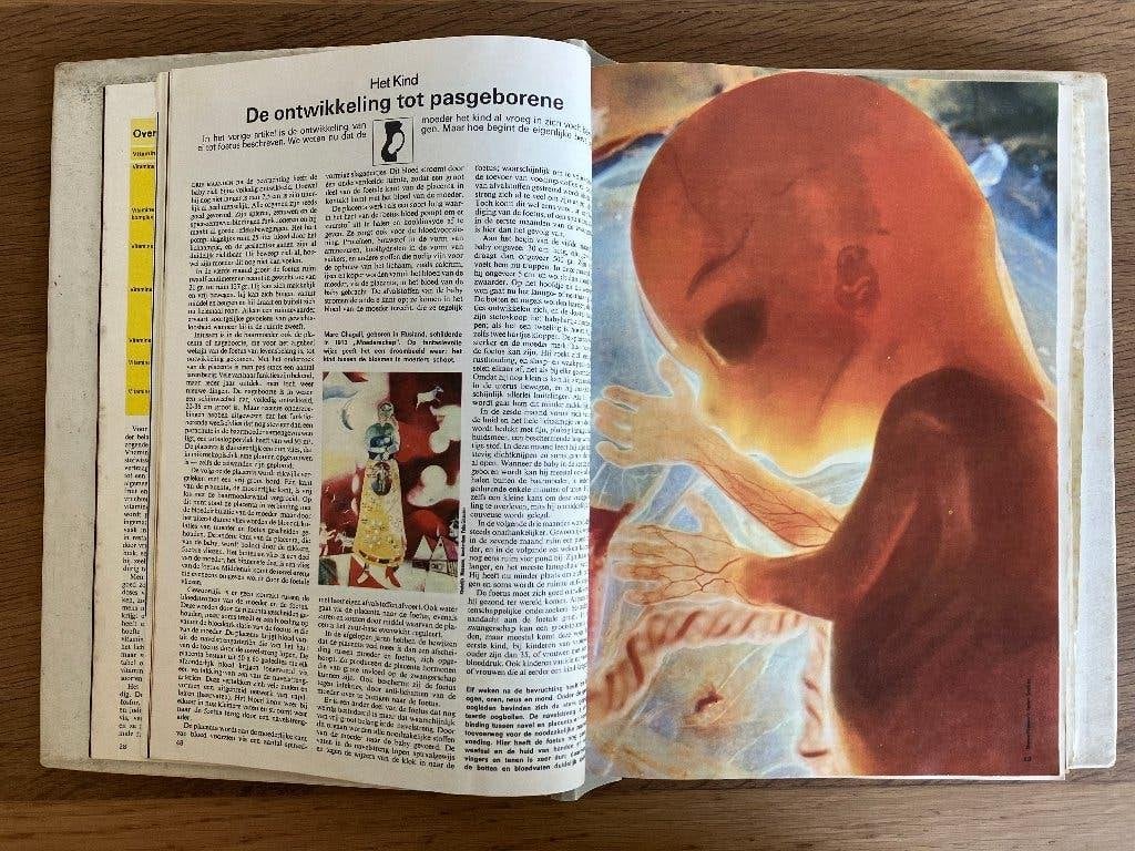 Encyclopédie de l'esprit et du corps : Le livre de l'homme, Livres, Encyclopédies, Enlèvement ou Envoi, Utilisé, Médecine