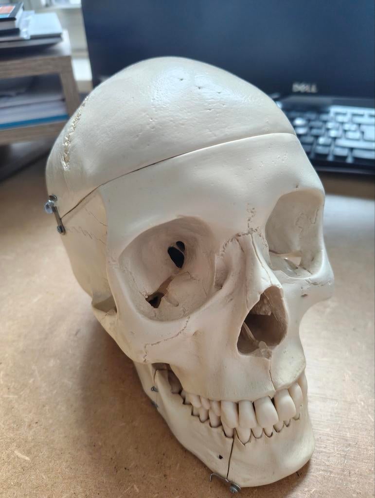 Schedel anatomie, Boeken, Ophalen